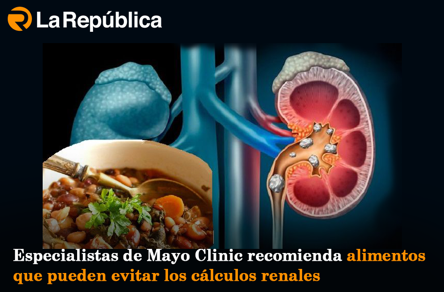  Especialistas de Mayo Clinic recomienda alimentos que pueden evitar los cálculos renales - Cover Image